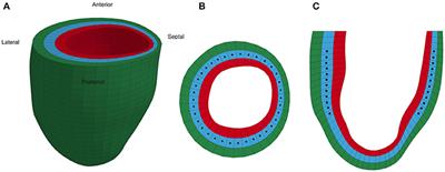 Evaluation of a Novel Finite Element Model of Active Contraction in the Heart